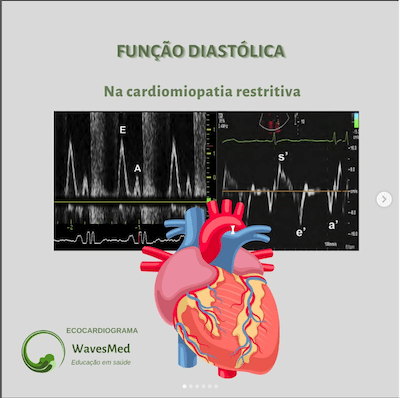 Função diastólica na miocardiopatia restritiva