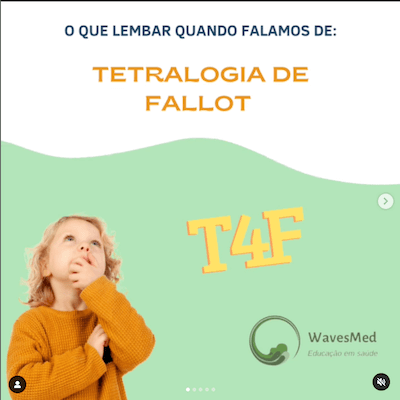 Tetralogia de Fallot Wavesmed