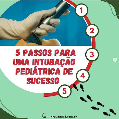 5 passos para Intubação Pediátrica Wavesmed