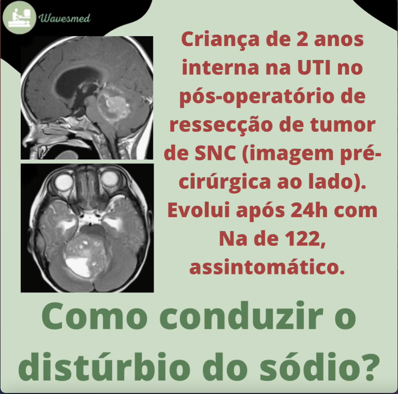 Distúrbios do sódio no pós operatório de neurocirurgia