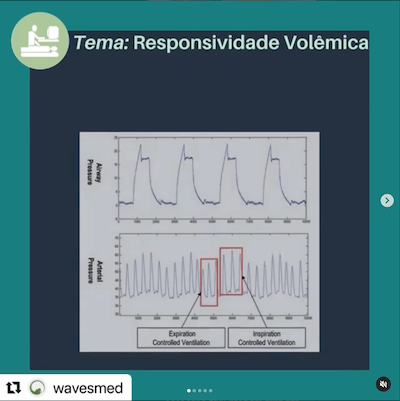 RESPONSIVIDADE VOLEMICA