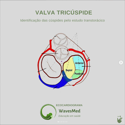 Valva tricúspide no ecocardiograma