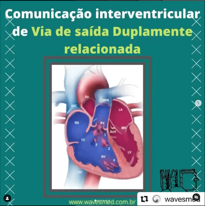 COMUNICAÇÃO INTERVENTRICULAR (CIV) DUPLAMENTE RELACIONADA