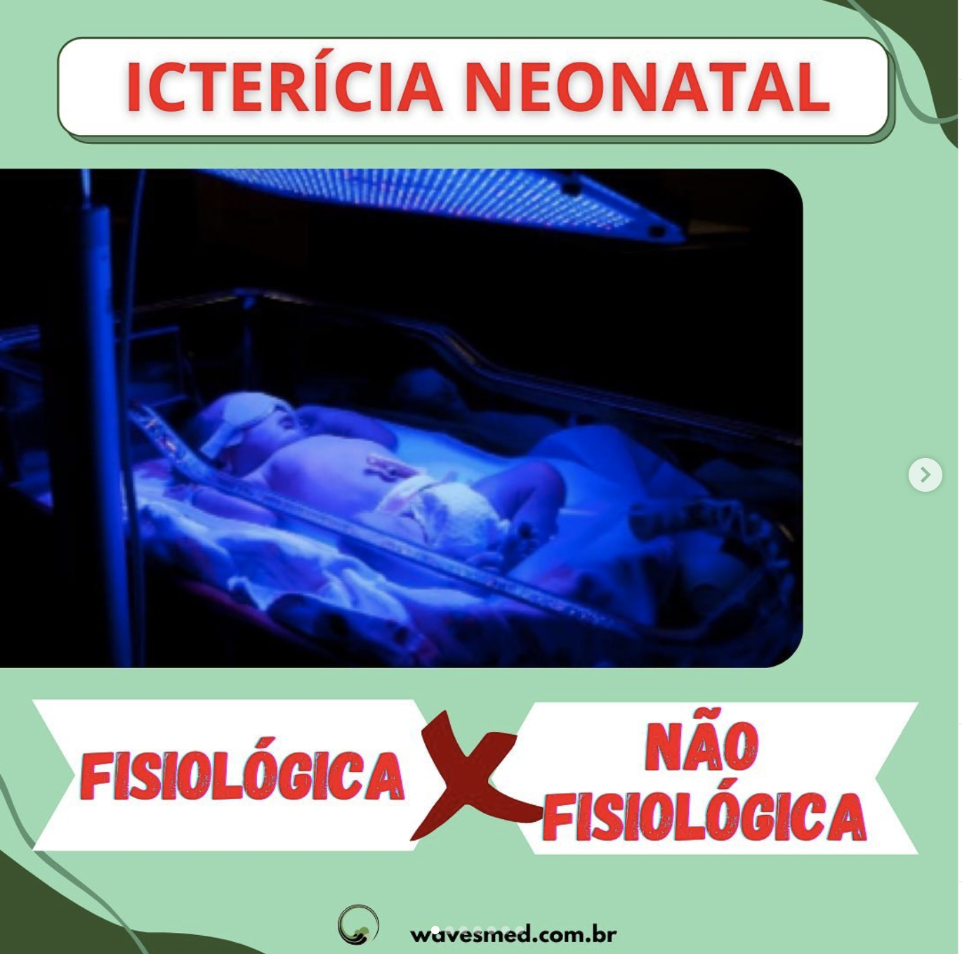 Icterícia Neonatal ❓Por que os bebês ficam ictéricos?