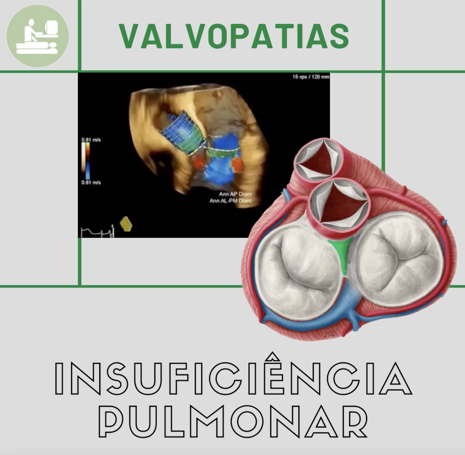 A insuficiência pulmonar é fisiológica e pode ser observada em 75% da população, principalmente em crianças.