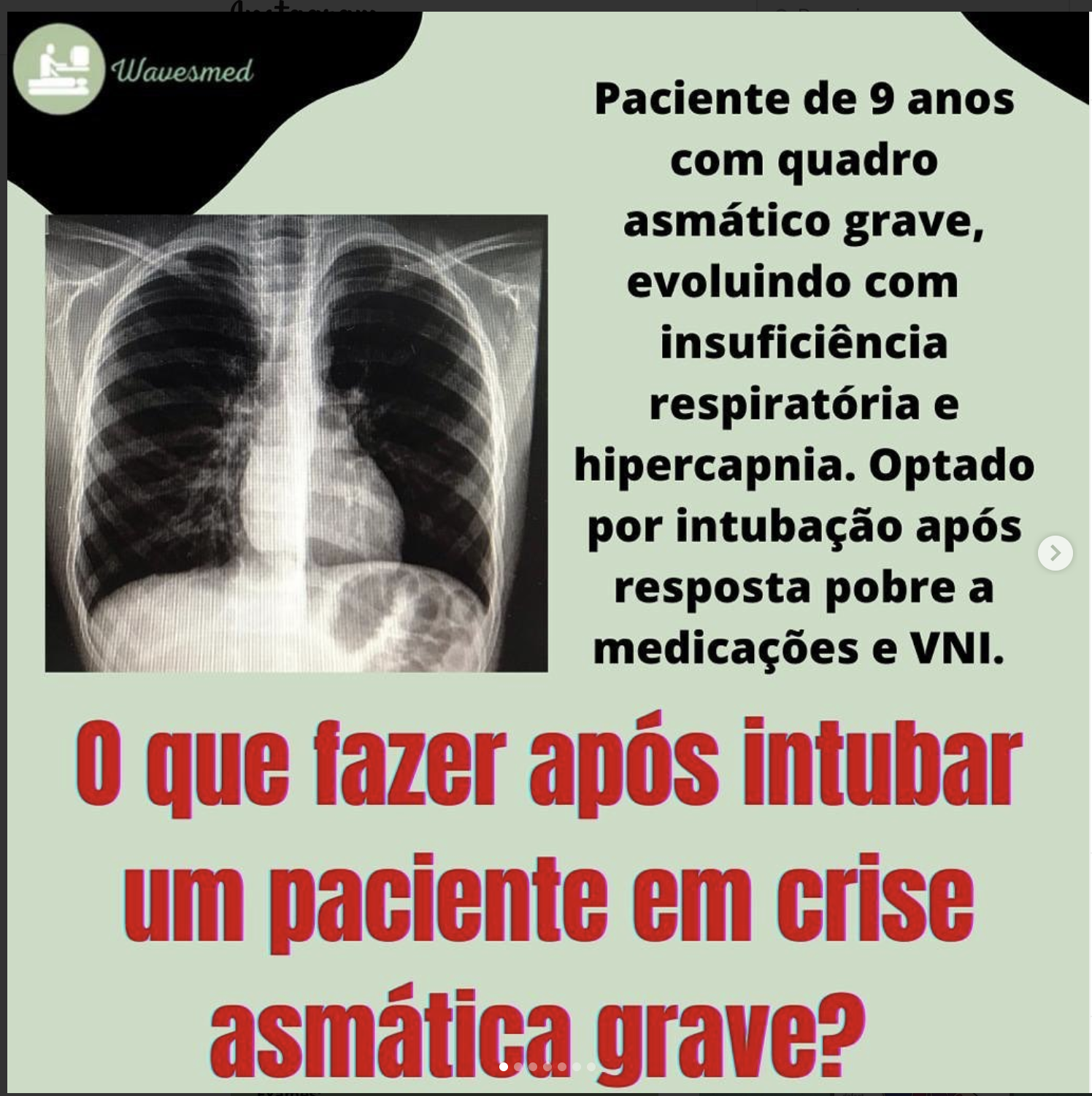 O que fazer após intubar um paciente com crise asmática grave?