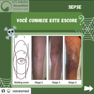 Mottling Score