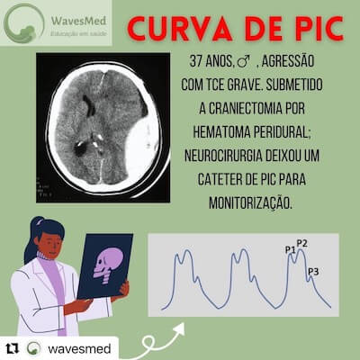 Neurointensivismo