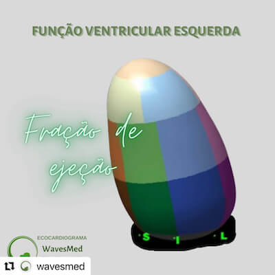 Fração de Ejeção Wavesmed