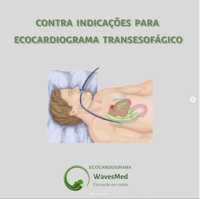 Contra indicações para o Ecocardiograma Transesofágico Wavesmed