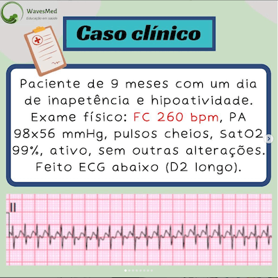 Taquicardia supraventricular em pediatria