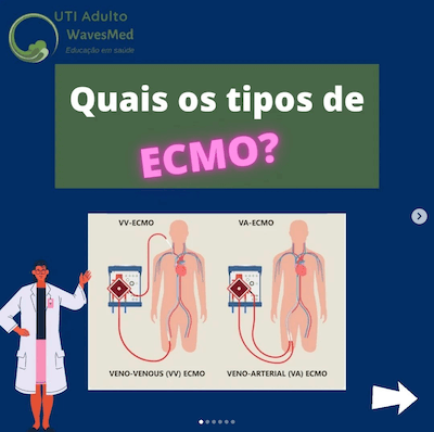 Quais os tipos de ECMO?