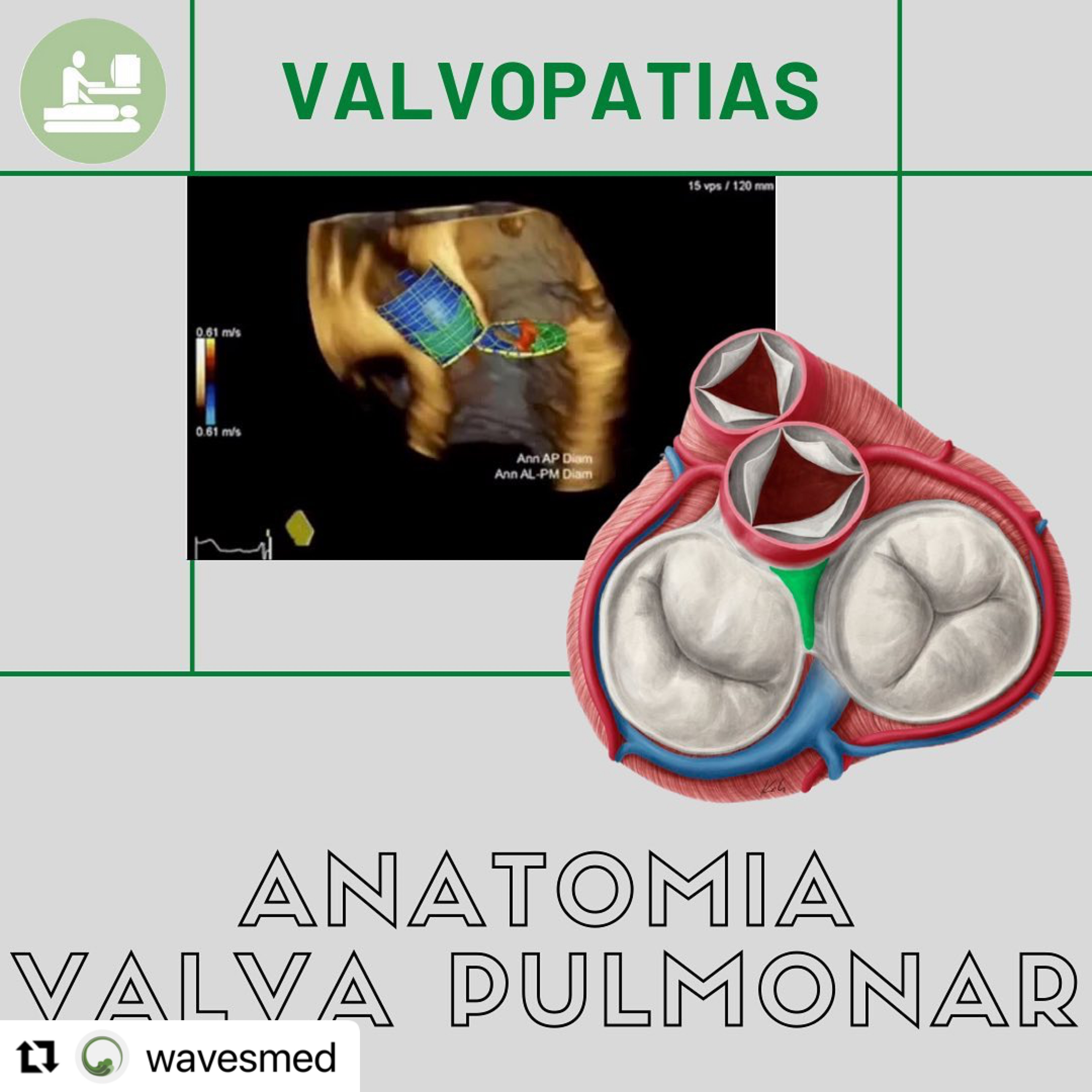 Anatomia da Valva pulmonar Wavesmed