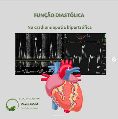 Avaliação da função diastólica na cardiomiopatia hipertrófica