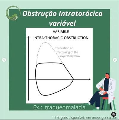 Obstrução intratorácica variável curva ventilação mecânica wavesmed