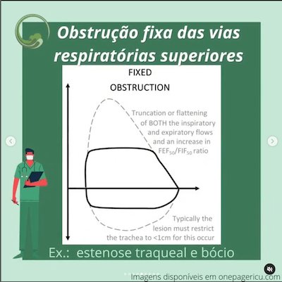 Obstrução fixa vias aéreas superiores curva ventilação mecânica wavesmed