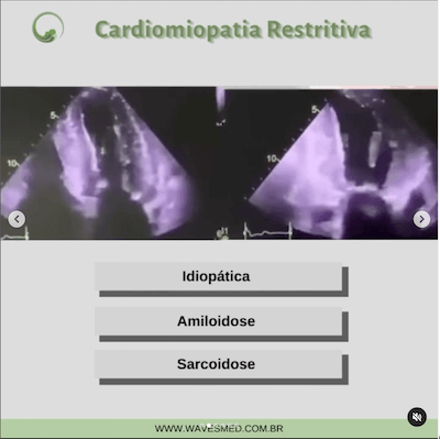 Amioloidose função diastólica cardiomiopatia restritiva wavesmed