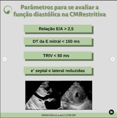 Parâmetros avaliar função diastólica cardiomiopatia restritiva wavesmed