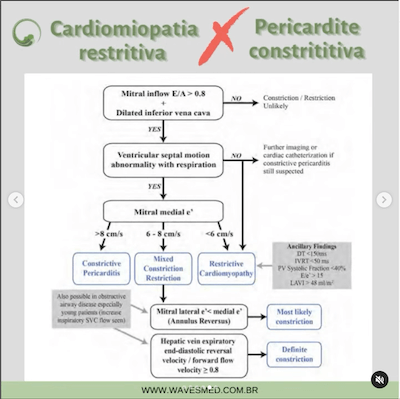 Cardiomiopatia restritiva pericardite constritiva função diastólica cardiomiopatia restritiva wavesmed