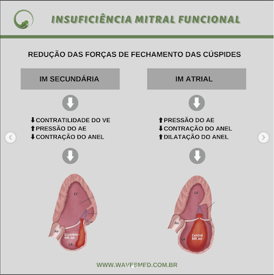 Insuficiência mitral funcional insuficiência mitral atrial wavesmed