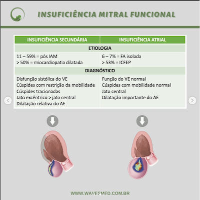 Im funcional insuficiência mitral atrial wavesmed