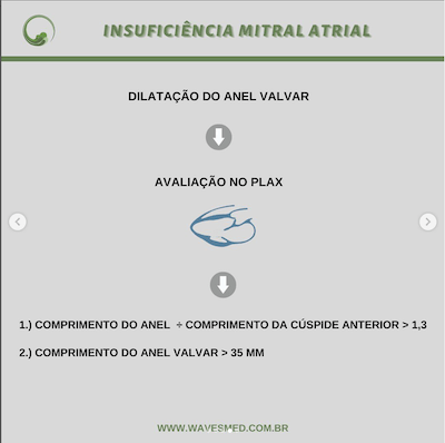 Dilatação do anel valvar insuficiência mitral atrial wavesmed