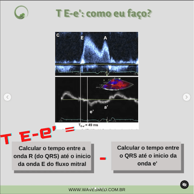 Como eu faço função diastólica nas valvopatias wavesmed