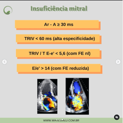 Insuficiência mitral função diastólica nas valvopatias wavesmed