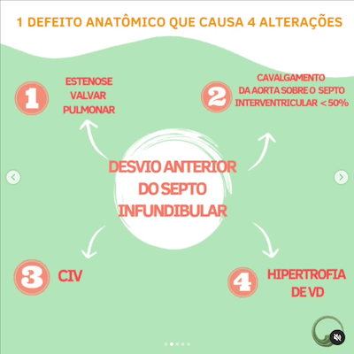 Defeito anatômico tetralogia de fallot wavesmed