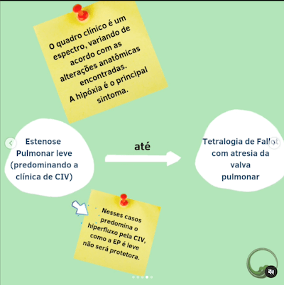 Estenose pulmonar tetralogia de fallot wavesmed