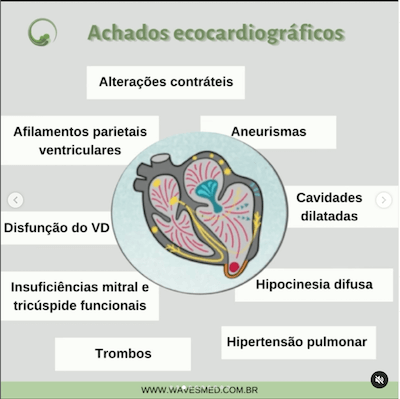 Achados ecocardiográficos ecocardiografia miocardiopatia chagásica wavesmed