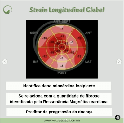 Strain ecocardiografia miocardiopatia chagásica wavesmed