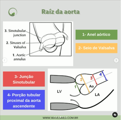 Raiz da aorta anatomia da aorta wavesmed