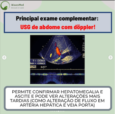 Exame complementar doença veno oclusiva wavesmed