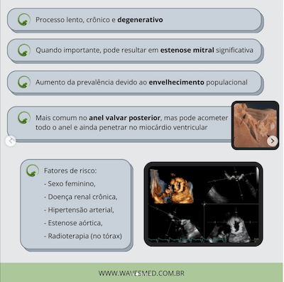 Fatores de risco calcificação do anel mitral wavesmed