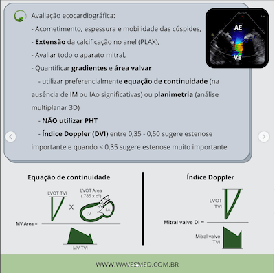 Avaliação ecocardiográfica calcificação do anel mitral wavesmed