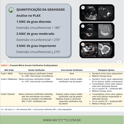 Quantificação gravidade calcificação do anel mitral wavesmed