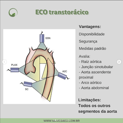 Eco transtorácico doenças da aorta janelas ecocardiográficas avaliação da aorta wavesmed