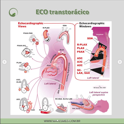 Planos eco transtorácico doenças da aorta janelas ecocardiográficas avaliação da aorta wavesmed