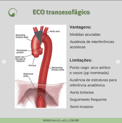 Eco transesofágico doenças da aorta anelas ecocardiográficas avaliação da aorta wavesmed