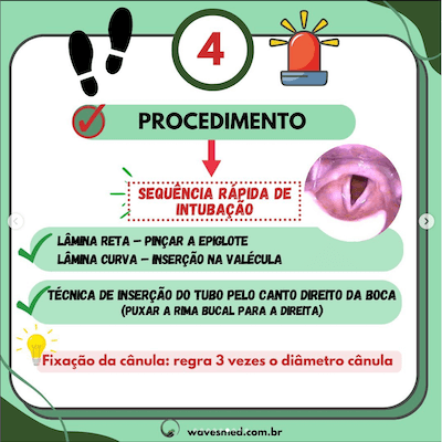 Procedimento passos intubação pediátrica de sucesso wavesmed