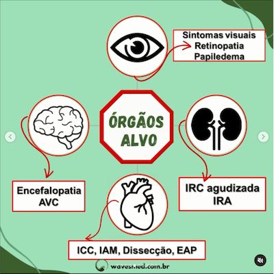 Sintomas crise hipertensiva wavesmed