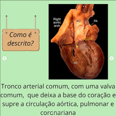 Descrição tac tronco arterial comum wavesmed