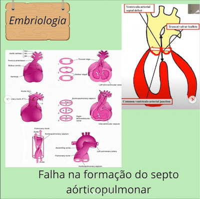 Embriologia tac tronco arterial comum wavesmed