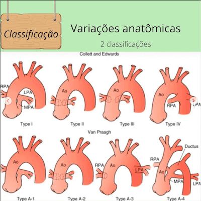 Classificação variações anatômicas tronco arterial comum wavesmed