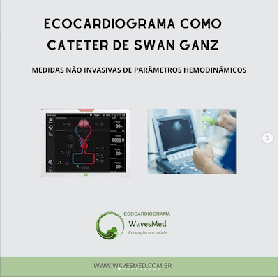 Ecocardiograma como cateter swan ganz wavesmed