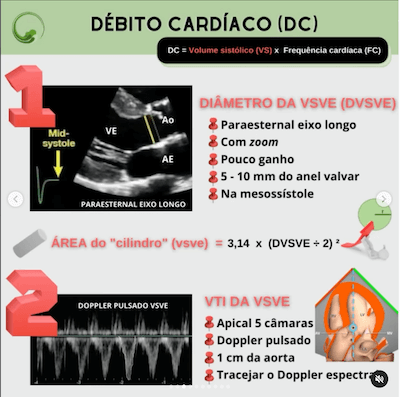 Calculo debito cardíaco ecocardiograma ecocardiograma como cateter swan ganz wavesmed