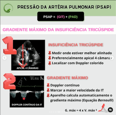 Psap ecocardiograma como cateter swan ganz wavesmed