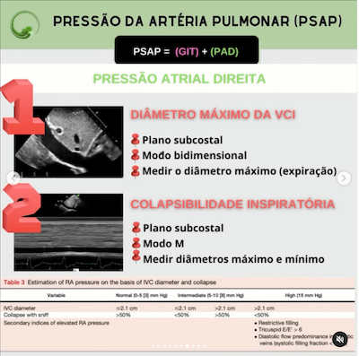 Pressão atrial direita ecocardiograma como cateter swan ganz wavesmed