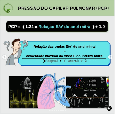 Pressão capilar pulmonar ecocardiograma ecocardiograma como cateter swan ganz wavesmed